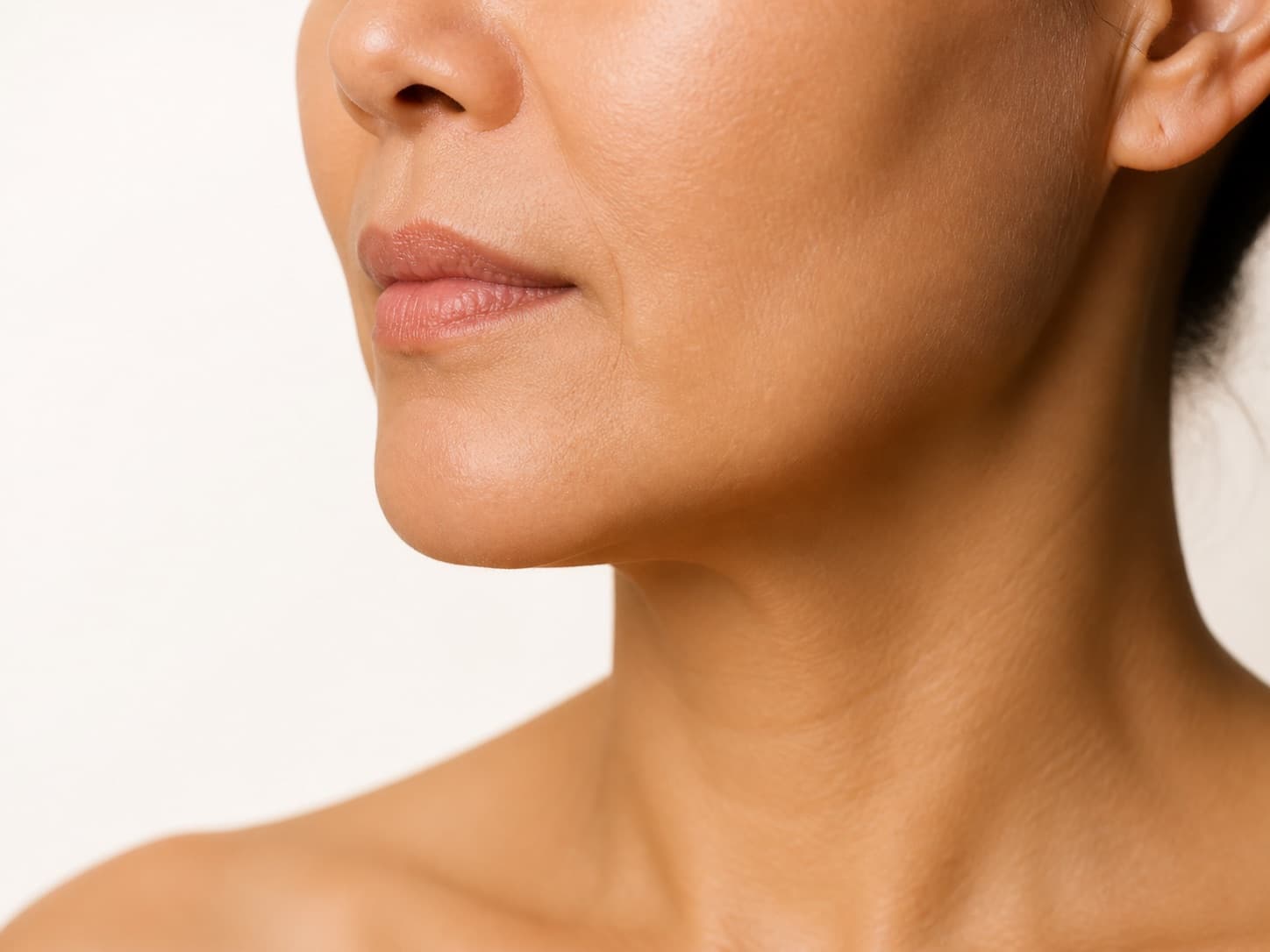 Sculptra