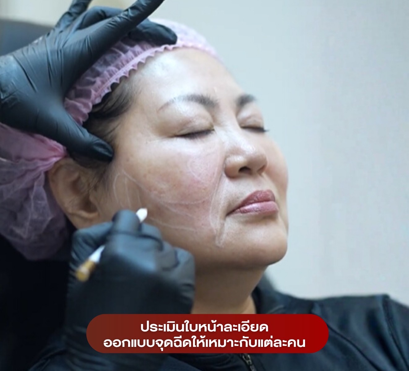 Neofilera Face Assessment